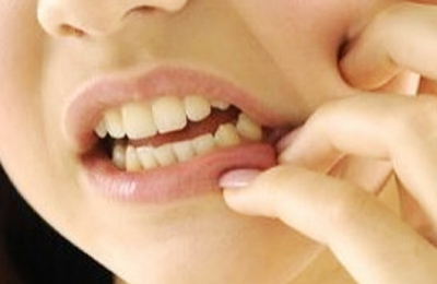 突發(fā)性、自發(fā)性的劇烈牙疼