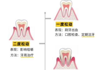 老年人牙齒松動了要怎么辦？