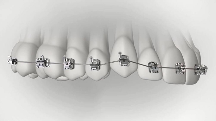 承德市哪家口腔醫(yī)院口腔正畸做得好？惟德口腔醫(yī)院來告訴您