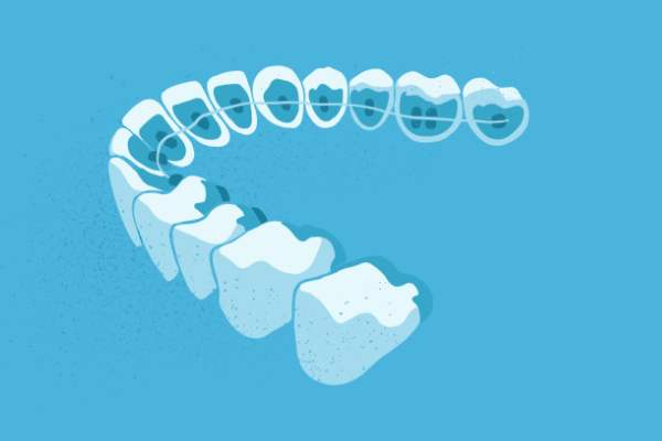 惟德口腔醫(yī)院口腔正畸好不好？